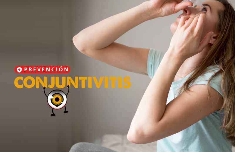 CONJUNTIVITIS