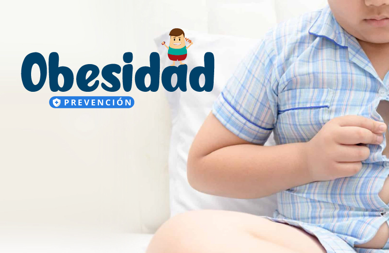 OBESIDAD