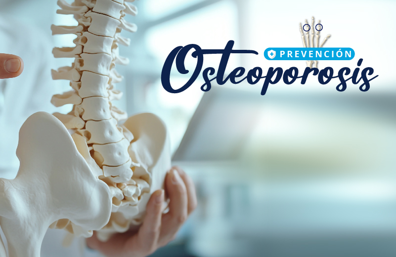 OSTEOPOROSIS